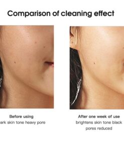 Alternative view of 7 IN 1 CLEANING FACE BRUSH - Professional Results for UK Clinics