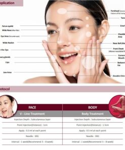 Miss Gisele Dermal Filler Treatment Areas Guide