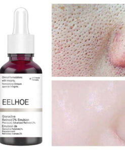 ANTI ACNE EXFOLIATING FACE SERUM PEELING SOLUTION PORE SHRINKING FACE SKIN CARE TREATMENTS SERUM - Professional Results for EU Clinics