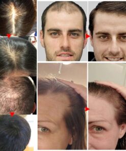 Alternative view of FAST NATURAL HAIR GROWING SERUM - Professional Results for USA Clinics