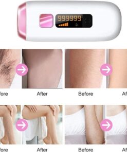 Alternative view of IPL HAIR REMOVAL - Professional Results for UK Clinics
