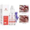 NAIL TREATMENT - Professional Results for UK Clinics