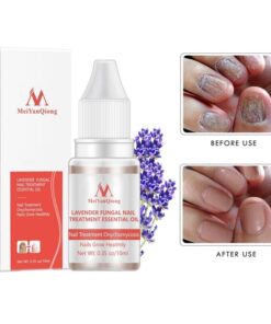 NAIL TREATMENT - Professional Results for UK Clinics